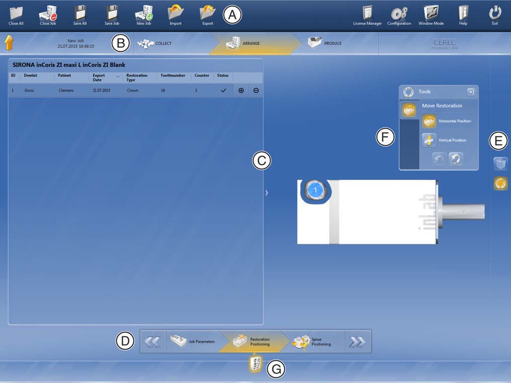 CEREC CAM SW 4.6.x interface
