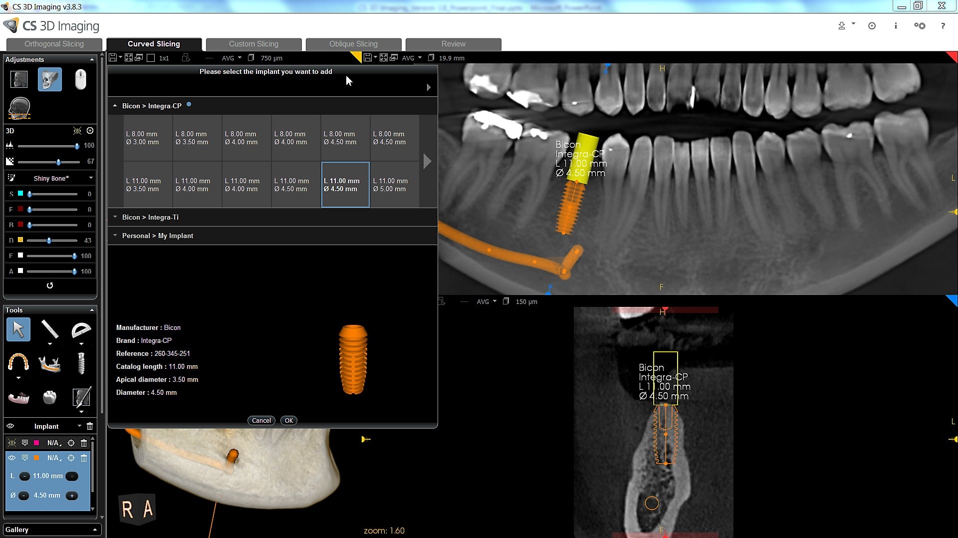 Carestream CS 3D Imaging illustration