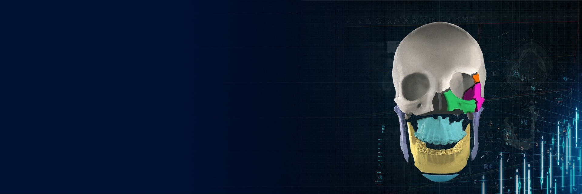Materialise Mimics Enlight CMF product illustration