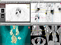 RadiAnt 3D MPR interface
