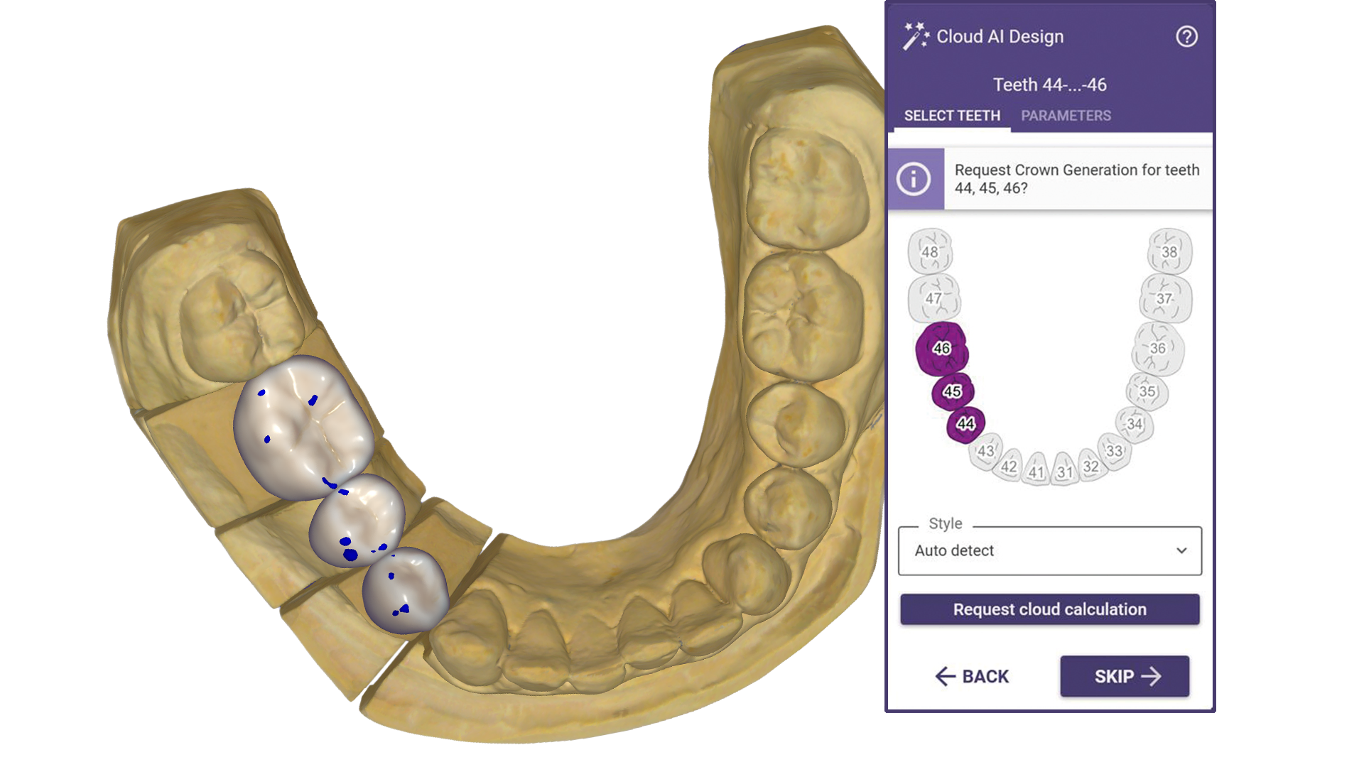 Official DentalCAD Chemnitz interface showing a dental restoration and the tooth selection panel